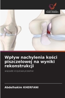 Wplyw nachylenia kosci piszczelowej na wyniki rekonstrukcji (Polish Edition) 6209410022 Book Cover