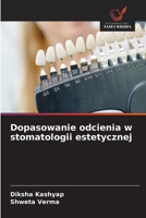 Dopasowanie odcienia w stomatologii estetycznej 6202454369 Book Cover