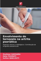 Envolvimento do tornozelo na artrite psoriática (Portuguese Edition) 6208546419 Book Cover