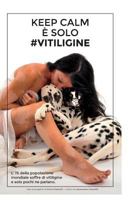 Keep Calm � Solo #Vitiligine 1535418117 Book Cover