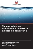 Tomographie par ordinateur à ouverture ajustée en dentisterie (French Edition) 6209848680 Book Cover