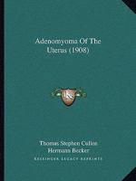 Adeno-Myome Des Uterus 1018558888 Book Cover