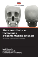 Sinus maxillaire et techniques d'augmentation sinusale (French Edition) 6630187547 Book Cover