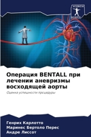 ???????? BENTALL ??? ??????? ????????? ?????????? ?????: ?????? ?????????? ????????? (Russian Edition) B0CJ48ZCDR Book Cover