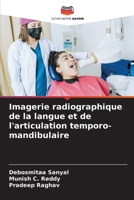 Imagerie radiographique de la langue et de l'articulation temporo-mandibulaire (French Edition) 620993014X Book Cover