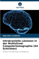 Intrakranielle Läsionen in der Multisliced-Computertomographie (64 Schichten): Handbuch der Radiologie und Bildgebung (German Edition) 6207672216 Book Cover