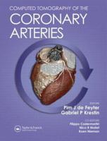 Computed Tomography of the Coronary Arteries 184184439x Book Cover