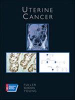 Uterine Cancer (American Cancer Society Atlas of Clinical Oncology) 1550091638 Book Cover