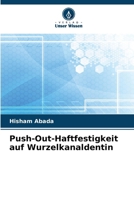 Push-Out-Haftfestigkeit auf Wurzelkanaldentin (German Edition) 6208141125 Book Cover