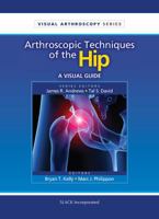 Arthroscopic Techniques of the Hip: A Visual Guide 1556428863 Book Cover