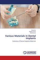 Vários materiais em implantes dentários: Evolução dos materiais de implantes dentários (Portuguese Edition) 6208429838 Book Cover