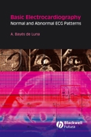 Basic Electrocardiography: Normal and Abnormal ECG Patterns 1405175702 Book Cover