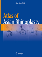Atlas of Asian Rhinoplasty 9811086443 Book Cover