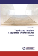 Tooth and Implant Supported Overdentures: Simplified 6200305587 Book Cover