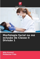 Morfologia facial na má oclusão de Classe II Divisão 1 (Portuguese Edition) 6208198666 Book Cover