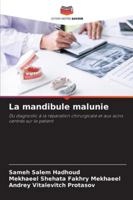 La mandibule malunie 620929815X Book Cover