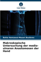 Makroskopische Untersuchung der medio-ulnaren Anastomosen der Hand 6630327845 Book Cover