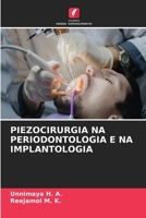 Piezocirurgia Na Periodontologia E Na Implantologia (Portuguese Edition) 6630427386 Book Cover