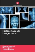 Histiocitose de Langerhans 6206974618 Book Cover