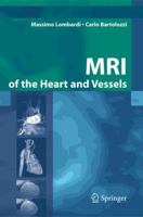 MRI of the Heart and Vessels 8847003067 Book Cover