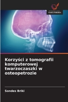 Korzysci z tomografii komputerowej twarzoczaszki w osteopetrozie 6209107524 Book Cover