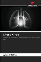Chest X-ray 6208570395 Book Cover