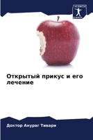 Открытый прикус и его лечение 6204173707 Book Cover