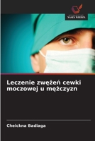 Leczenie zwezen cewki moczowej u mezczyzn (Polish Edition) 6630295595 Book Cover