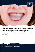 Влияние окклюзии зубов н 6203402869 Book Cover