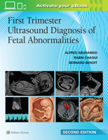 First Trimester Ultrasound Diagnosis of Fetal Abnormalities 1975242831 Book Cover