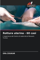 Rottura uterina - 60 casi 6207301145 Book Cover