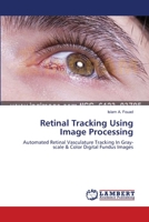 Retinal Tracking Using Image Processing 3659562335 Book Cover