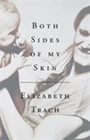 Both Sides of My Skin 1944354271 Book Cover