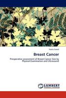 Breast Cancer: Preoperative assessment of Breast Cancer Size by Physical Examination and Ultrasound 3848418959 Book Cover