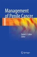 Management of Penile Cancer 1493904604 Book Cover