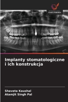 Implanty stomatologiczne i ich konstrukcja (Polish Edition) 6630101413 Book Cover