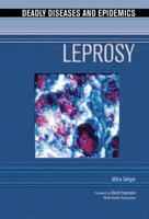 Leprosy (Deadly Diseases and Epidemics) 0791085023 Book Cover