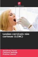 Lesões cervicais não cariosas (LCNC) (Portuguese Edition) 6209827160 Book Cover