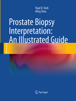 Prostate Biopsy Interpretation: An Illustrated Guide 3642213685 Book Cover