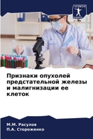 Признаки опухолей предстательной железы и малигнизации ее клеток 6204156764 Book Cover