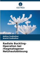 Radiale Buckling-Operation bei rhegmatogener Netzhautablösung (German Edition) 6209327419 Book Cover