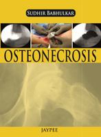 Osteonecrosis 9350904071 Book Cover