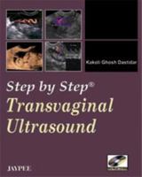 Transvaginal Ultrasound 8184483228 Book Cover