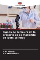 Signes de tumeurs de la prostate et de malignité de leurs cellules 620415673X Book Cover