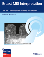 Breast MRI for Screening and Diagnosis : Text and Online Case Analysis 1626234671 Book Cover