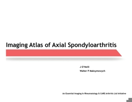 Imaging Atlas of Axial Spondyloarthritis 0228817579 Book Cover