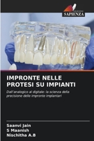 Impronte Nelle Protesi Su Impianti (Italian Edition) 6630283333 Book Cover