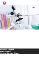 Teste de actividade de cárie: Potente ferramenta para a prevenção de cáries dentárias (Portuguese Edition) 620493953X Book Cover