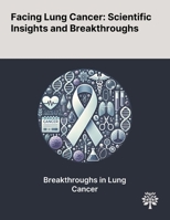Facing Lung Cancer: Scientific Insights and Breakthroughs 102290115X Book Cover