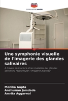 Une symphonie visuelle de l'imagerie des glandes salivaires (French Edition) 6202329564 Book Cover